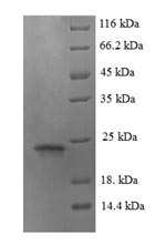 Recombinant Mouse Angiopoietin-like protein 8(Angptl8) 
