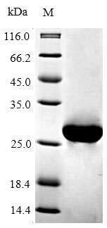Recombinant Mouse Apoptosis regulator Bcl-2(Bcl2),partial