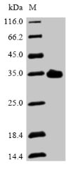 Recombinant Mouse Asialoglycoprotein receptor 2 (Asgr2),partial