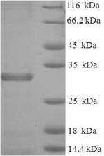 Recombinant Mouse Baculoviral IAP repeat-containing protein 5(Birc5)