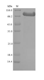 Recombinant Mouse Beta-adrenergic receptor kinase 1(Grk2)