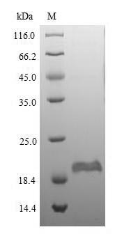 Recombinant Mouse Beta-defensin 1(Defb1)