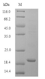 Recombinant Mouse Bis(5'-adenosyl)-triphosphatase(Fhit)