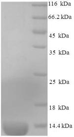 Recombinant Mouse C-C motif chemokine 2(Ccl2),partial