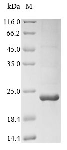Recombinant Mouse C-X-C chemokine receptor type 3(Cxcr3),partial