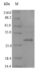 Recombinant Mouse C-type lectin domain family 4 member K(Cd207),partial