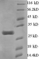 Recombinant Mouse Calcium-dependent phospholipase A2(Pla2g5)