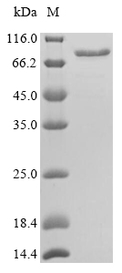 Recombinant Mouse Calreticulin(Calr)