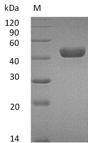 Recombinant Mouse Carbonic anhydrase 14(Ca14),partial (Active)