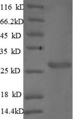 Recombinant Mouse Cathepsin S(Ctss)