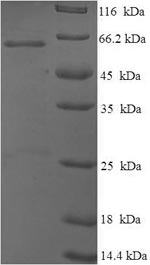 Recombinant Mouse Cellular tumor antigen p53(Tp53)