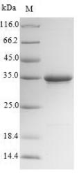 Recombinant Mouse Collectrin(Cltrn),partial