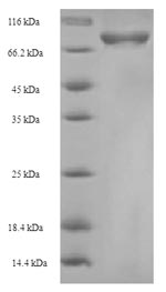 Recombinant Mouse Cysteine sulfinic acid decarboxylase(Csad)