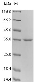 Recombinant Mouse Cytotoxic T-lymphocyte protein 4(Ctla4),Partial