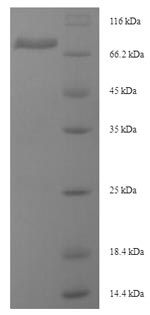 Recombinant Mouse Desmoglein-3(Dsg3),partial