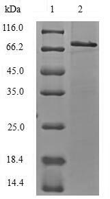 Recombinant Mouse E3 ubiquitin-protein ligase TRIM21(Trim21)