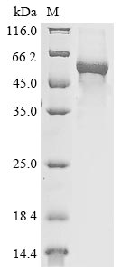 Recombinant Mouse E3 ubiquitin-protein ligase TRIM21(Trim21)