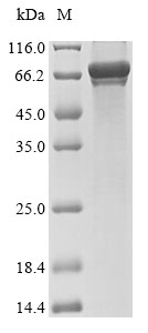 Recombinant Mouse E3 ubiquitin-protein ligase parkin(Prkn)