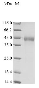 Recombinant Mouse Enteropeptidase(Tmprss15),partial