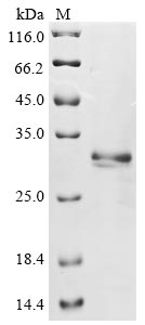 Recombinant Mouse Epithelial cell adhesion molecule(Epcam),partial