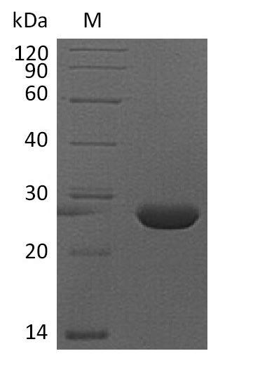 Recombinant Mouse Fibroblast growth factor 9(Fgf9) (Active)