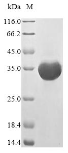 Recombinant Mouse Formyl peptide receptor 2(Fpr2),partial