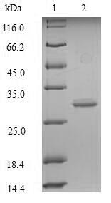 Recombinant Mouse Glucagon-like peptide 1 receptor(Glp1r),partial