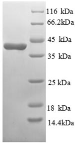 Recombinant Mouse Glucagon receptor(Gcgr),partial