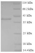 Recombinant Mouse Glutathione S-transferase P 1(Gstp1)