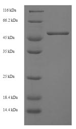 Recombinant Mouse H-2 class I histocompatibility antigen, D-D alpha chain(H2-D1),partial