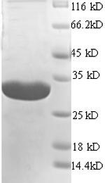 Recombinant Mouse H-2 class II histocompatibility antigen gamma chain(Cd74) ,partial