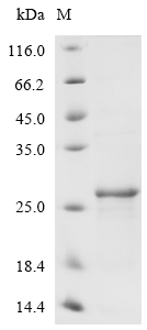 Recombinant Mouse Heme-binding protein 1(Hebp1)