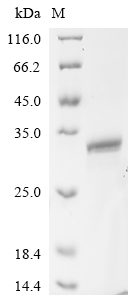 Recombinant Mouse Heme-binding protein 1(Hebp1)