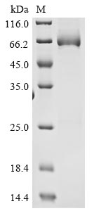 Recombinant Mouse High affinity cGMP-specific 3,5-cyclic phosphodiesterase 9A(Pde9a)