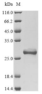 Recombinant Mouse High mobility group protein B1(Hmgb1)