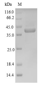 Recombinant Mouse Homeobox protein Nkx-3.2(Nkx3-2)