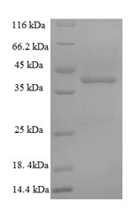 Recombinant Mouse Hyaluronan synthase 2(Has2),partial