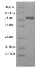 Recombinant Mouse Hyaluronan synthase 2(Has2),partial