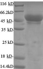 Recombinant Mouse Hydroxyacyl-coenzyme A dehydrogenase, mitochondrial(Hadh)