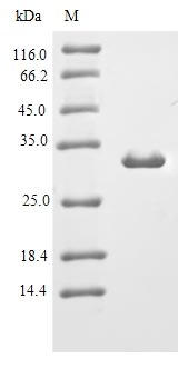 Recombinant Mouse Immunoglobulin J chain(Jchain)