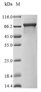 Recombinant Mouse Interleukin-1 receptor-associated kinase 3(Irak3)