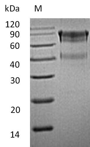 Recombinant Mouse Interleukin-15 receptor subunit alpha(Il15ra),partial (Active)