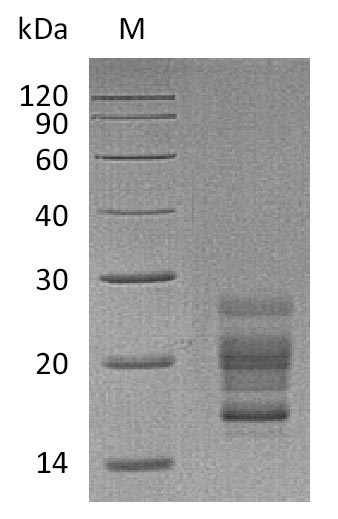 Recombinant Mouse Interleukin-17A(Il17a),partial (Active)