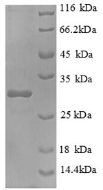 Recombinant Mouse Interleukin-2 receptor subunit beta(Il2rb),partial