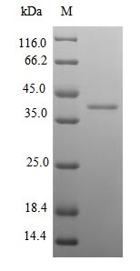 Recombinant Mouse Kallikrein-14(Klk14)