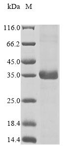 Recombinant Mouse Ketohexokinase(Khk)