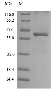 Recombinant Mouse Legumain(Lgmn)
