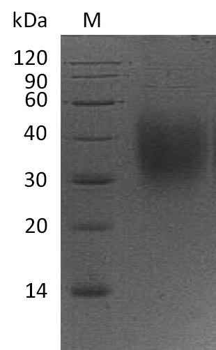 Recombinant Mouse Leukocyte surface antigen CD47(Cd47),partial (Active)