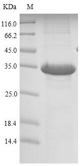 Recombinant Mouse Lithostathine-1(Reg1)