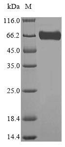 Recombinant Mouse Lysosomal acid Glucosylceramidase(Gba)